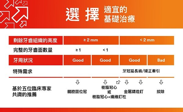 牙齒修復指南–選擇適宜的基礎治療