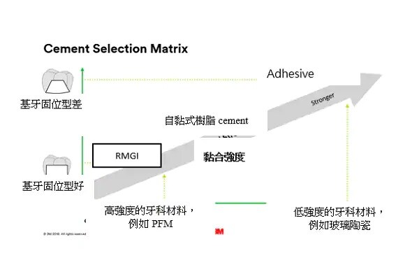 牙科黏合劑 (cement)選擇表