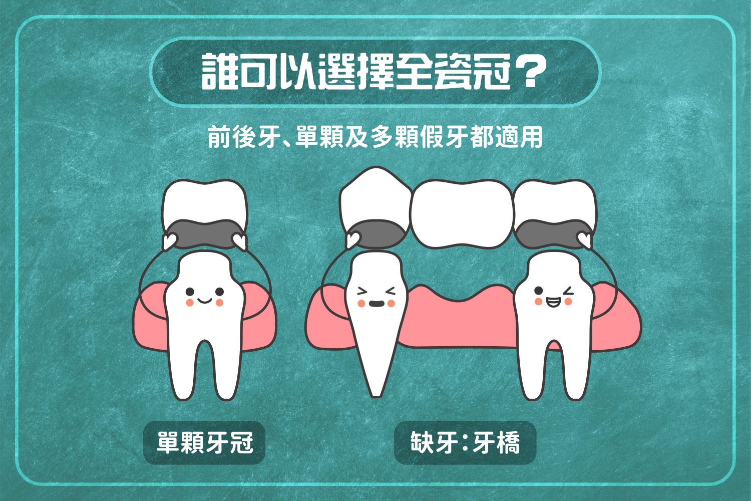 我適合全瓷冠假牙嗎？