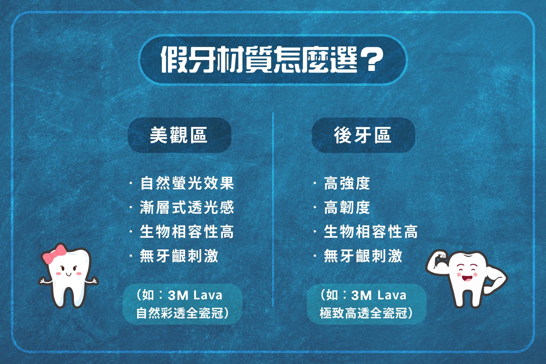 全瓷冠假牙比較