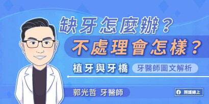 缺牙怎麼辦？不處理會怎樣？了解植牙與牙橋的差別