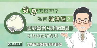 蛀牙怎麼辦？為何抽神經？了解假牙材質、製作流程