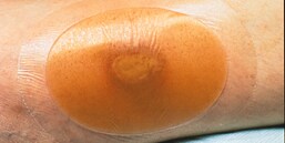 3M™ Tegaderm™ 親水性敷料