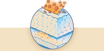 Cake-Resistant Filter Media
