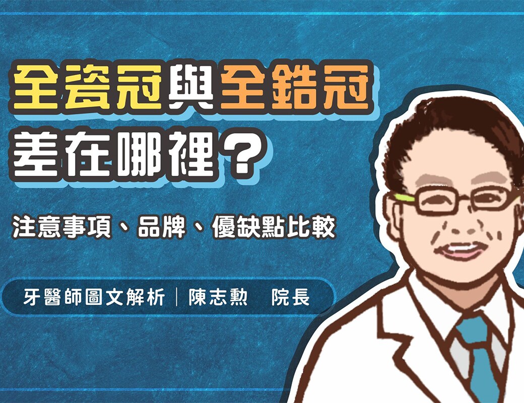 全瓷冠假牙完整介紹│全瓷冠是什麼？費用、種類、優缺點比較
