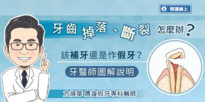 牙齒掉落、斷裂怎麼辦？該補牙還是做假牙？