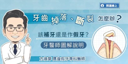 牙齒掉落、斷裂怎麼辦？該補牙還是做假牙？