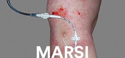 醫療黏性產品相關皮膚損傷(MARSI)