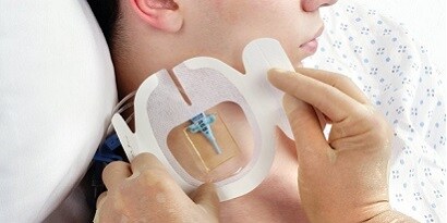 使用導管覆蓋敷料的患者