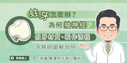 蛀牙怎麼辦？為何抽神經？了解假牙材質、製作流程