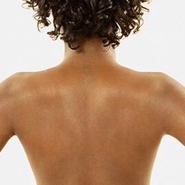The patient’s skin is the biggest risk factor for SSIs