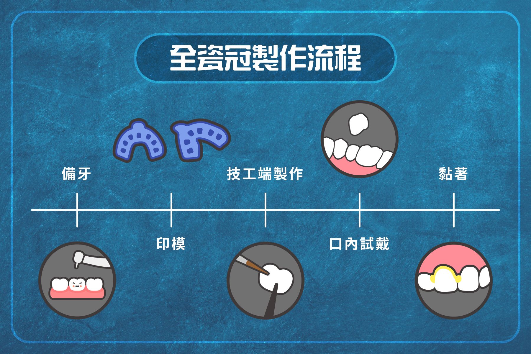 全瓷冠假牙 vs. 傳統假牙